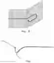 Fig. 05 - Medical device curving system