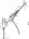 Fig. 03 - Vascular access instrument having a fluid permeable structure, and related devices and methods