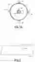 Fig. 03 - Catheter systems and methods for performing a destruction of a body obstruction