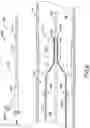 Fig. 09 - Catheter systems and methods for performing a destruction of a body obstruction