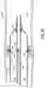 Fig. 17 - Catheter systems and methods for performing a destruction of a body obstruction