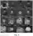 Fig. 11 - Apparatus for creating resonant standing waves in biological tissue