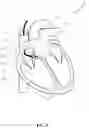 Fig. 02 - Single conduit multi-electrode cardiac pacemaker
