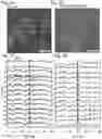 Fig. 06 - Device and method for neurostimulation