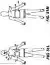 Fig. 49 - Obstructive sleep apnea treatment devices, systems and methods