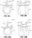 Fig. 09 - Implantable pulse generator headers including conductors having offset segments