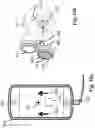 Fig. 33 - Method for treating a patient having a pelvic floor dysfunction