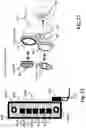 Fig. 35 - Method for treating a patient having a pelvic floor dysfunction
