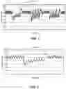 Fig. 02 - Methods and systems for lowering blood pressure through reduction of ventricle filling
