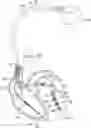 Fig. 01 - Method and device for managing pacing therapy based on interventricular septal activity