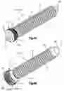 Fig. 07 - Electrical Stimulation Screws