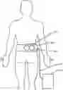 Fig. 01 - Systems and methods for spasticity treatment using spinal nerve magnetic stimulation