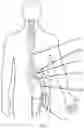 Fig. 02 - Systems and methods for spasticity treatment using spinal nerve magnetic stimulation