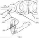 Fig. 03 - Systems and methods for spasticity treatment using spinal nerve magnetic stimulation