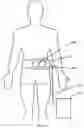 Fig. 05 - Systems and methods for spasticity treatment using spinal nerve magnetic stimulation