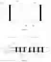 Fig. 07 - Catheter apparatus and brachytherapy system