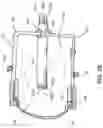 Fig. 04 - RAPID PULSE ELECTROHYDRAULIC (EH) SHOCKWAVE GENERATOR APPARATUS AND METHODS FOR MEDICAL AND COSMETIC TREATMENTS
