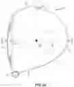 Fig. 04 - Golf club head with adjustable resting face angle