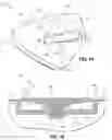 Fig. 11 - Golf club head with adjustable resting face angle