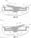 Fig. 12 - Golf club head with adjustable resting face angle