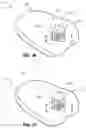 Fig. 17 - Golf club head with adjustable resting face angle