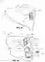 Fig. 26 - Golf club head with adjustable resting face angle