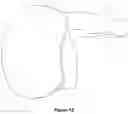 Fig. 14 - One-Grip Table Tennis Paddle