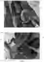 Fig. 12 - TOY