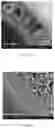 Fig. 10 - Hemodialyzer for blood purification