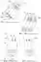 Fig. 02 - Gas liquid absorption device (GLAD) with replaceable gas orifice fittings and sensors