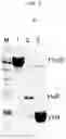 Fig. 04 - METHOD AND STATIONARY PHASE FOR ISOLATING EXTRACELLULAR VESICLES FROM BIOLOGICAL MATERIAL