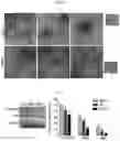 Fig. 07 - METHOD AND STATIONARY PHASE FOR ISOLATING EXTRACELLULAR VESICLES FROM BIOLOGICAL MATERIAL