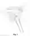 Fig. 04 - Carwash machine