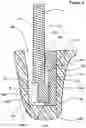 Fig. 07 - Manual blade sharpening tool