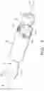 Fig. 04 - Boom arm for positioning an auxiliary electrical device