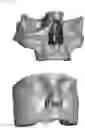 Fig. 03 - ANATOMICAL SILICON MODELS AND ADDITIVE MANUFACTURING THEREOF