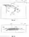 Fig. 11 - Hollow bladder repair process