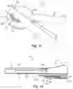 Fig. 09 - Gem applicator assembly