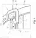 Fig. 05 - Towing assembly for motor vehicle