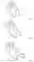 Fig. 07 - Spring control arm