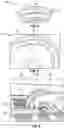 Fig. 03 - Broken wheel detection on railroad trains