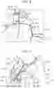 Fig. 06 - Vehicle side body structure