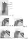 Fig. 05 - Grouped screw bunch and related method and machine for production of the same