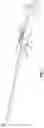 Fig. 02 - Gripper for holding a wind turbine blade and method of holding a wind turbine blade