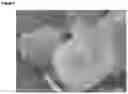 Fig. 03 - HIGHLY EFFICIENT SOLIDOTHERMAL SYNTHESIS OF ZEOLITIC MATERIALS