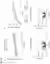 Fig. 13 - Compositions and methods for treating age-related diseases