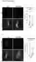 Fig. 32 - Compositions and methods for treating age-related diseases