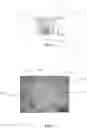 Fig. 05 - Mesofluidic device for culture of cell aggregates