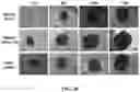 Fig. 19 - Mesofluidic device for culture of cell aggregates