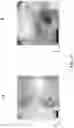 Fig. 22 - Mesofluidic device for culture of cell aggregates